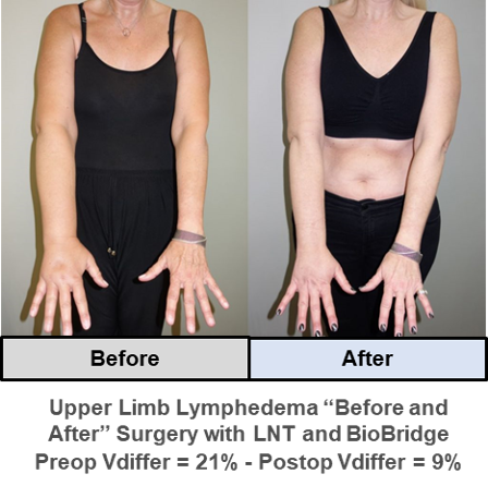 BioBridge Case Study